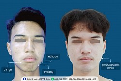 Aa